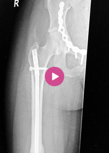 Holly’s reminder to drive safe